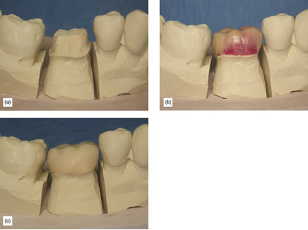 Anatomical design of coping